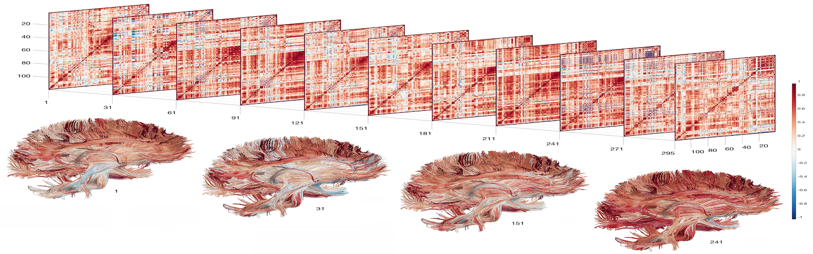 Medical images of a human brain with four images of the brain with several charts based on the data in the brain images.