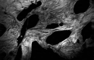Human breast tissue imaged with transient lighting